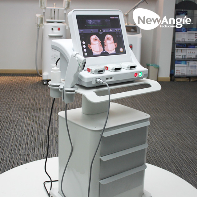 High intensity focused ultrasound for face lifting